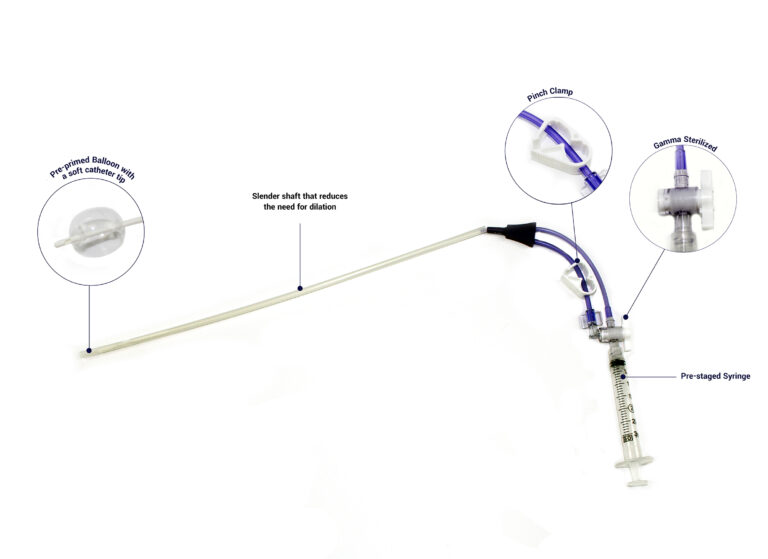 Miller Advance HSG Catheter MedGyn